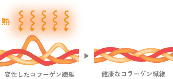 コラーゲン繊維の産生イラスト