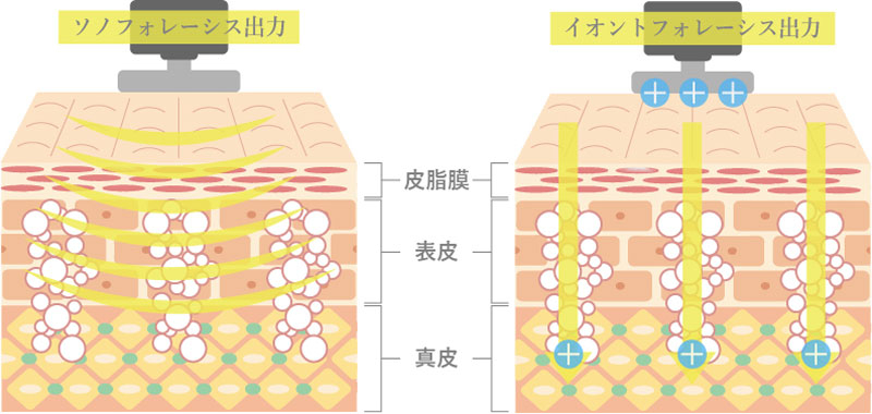 アクアダーマの効果イラスト